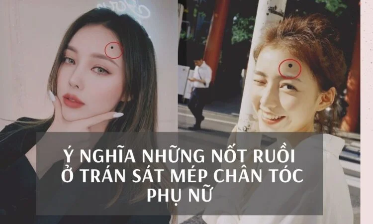 Giải mã ý nghĩa 10 vị trí nốt ruồi ở trán sát mép chân tóc phụ nữ