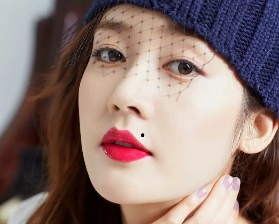 nốt ruồi duyên trên miệng