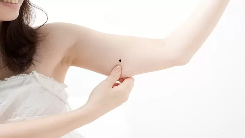 Có nên xóa nốt ruồi ở bắp tay trái nữ hay không? Bí ẩn về vận mệnh mà bạn chưa biết