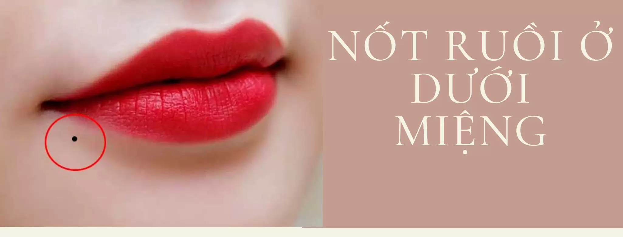 Nốt ruồi ở dưới miệng