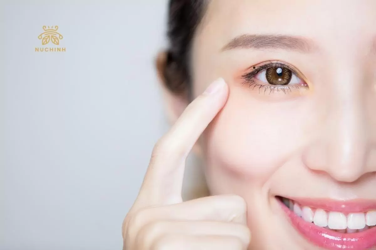 nốt ruồi trong mí mắt