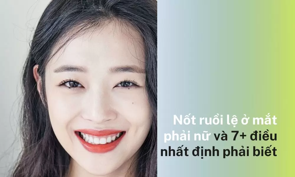 Nốt ruồi lệ ở mắt phải nữ