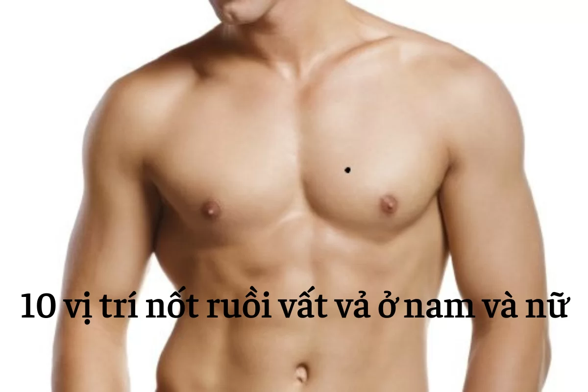 Nốt ruồi vất vả
