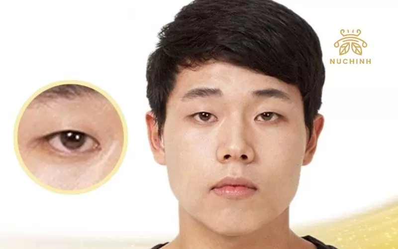 Mắt 1 mí là gì – Tính cách của người có mắt 1 mí