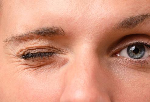 Tình trạng mí mắt dưới bên phải giật liên tục là như thế nào?