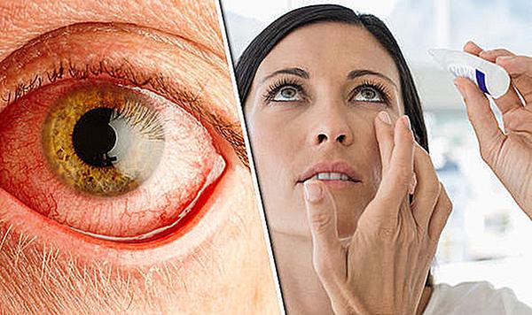 Gây đau mắt, ảnh hưởng đến sức khỏe mắt