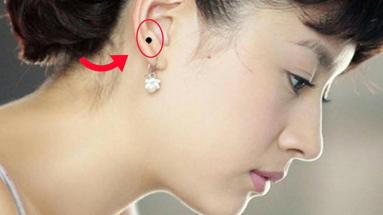 Nốt ruồi ở vành tai phải nữ
