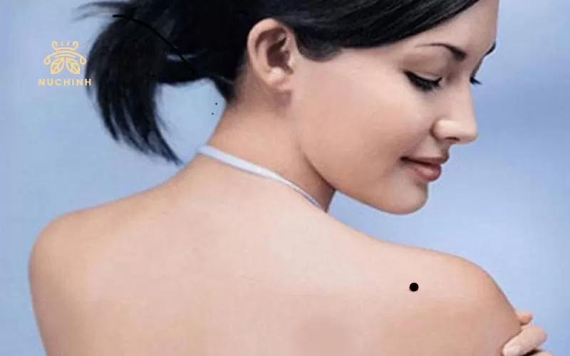 Nốt ruồi ở bả vai phải nữ