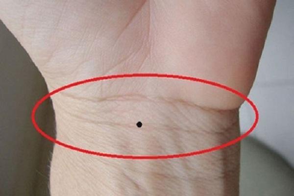 Ý nghĩa Nốt ruồi ở cổ tay trái phụ nữ