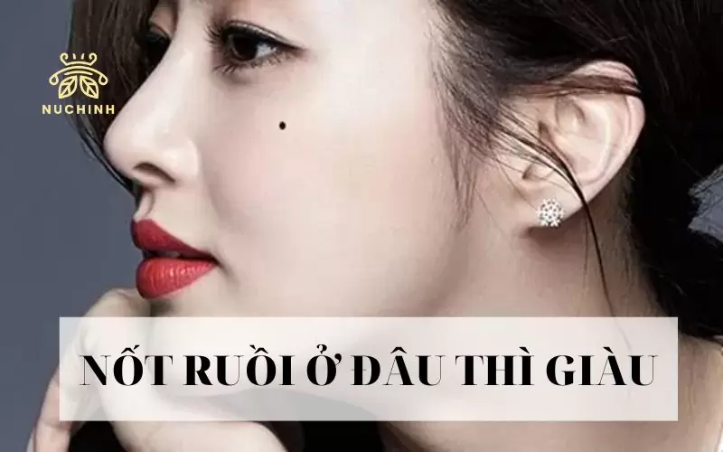 Nốt ruồi ở đâu thì giàu