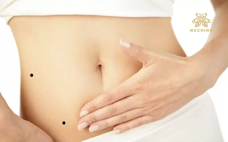 Nốt ruồi ở eo phải phụ nữ mang ý nghĩa vận mệnh gì?