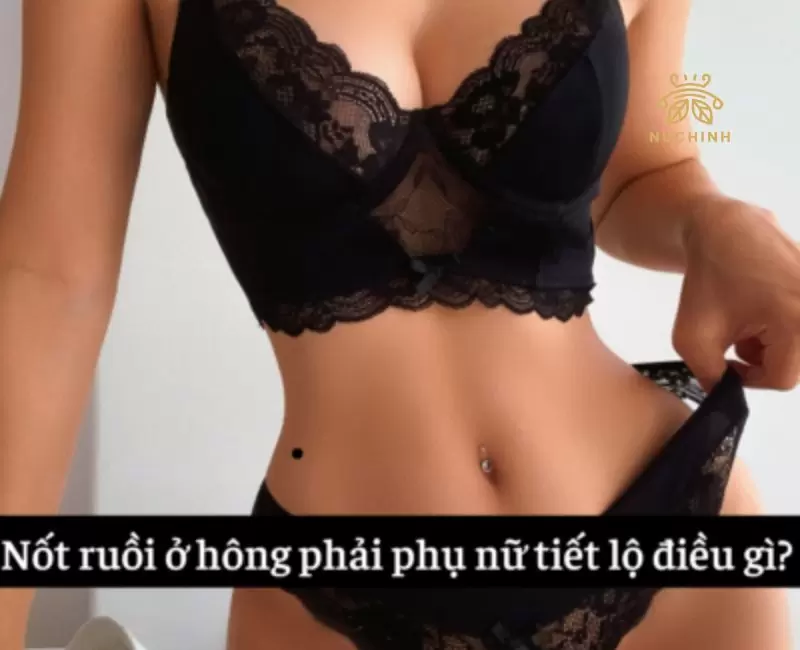 nốt ruồi ở hông phải phụ nữ