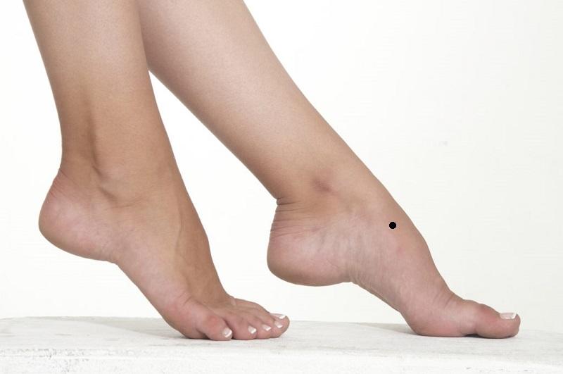 Có nên xóa nốt ruồi ở mép bàn chân không?