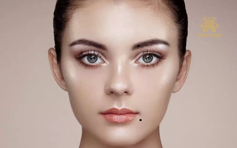 Nốt ruồi ở mép môi dưới
