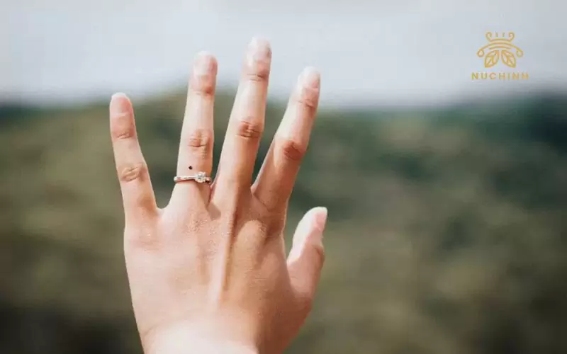 Nốt ruồi ở ngon tay áp út