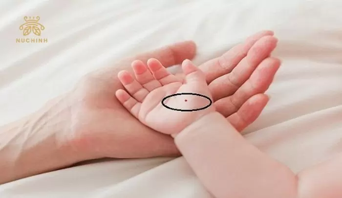 nốt ruồi phú quý trong lòng bàn tay
