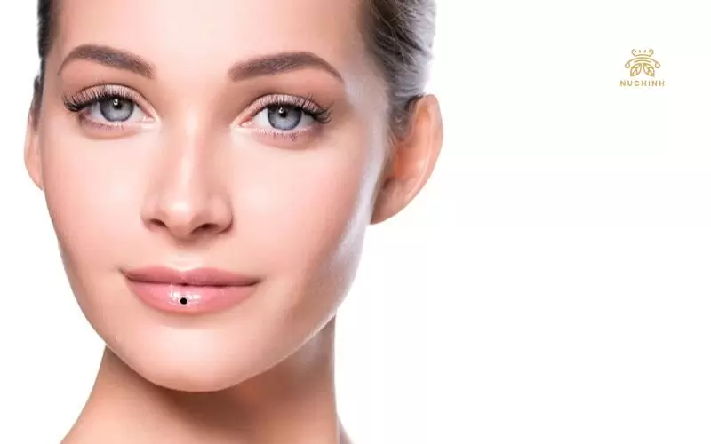 Nốt ruồi son ở môi dưới