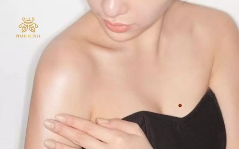 nốt ruồi son ở ngực trái phụ nữ