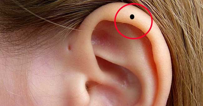 Nốt ruồi ở vành tai phụ nữ có ý nghĩa gì?