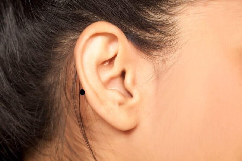 Nốt ruồi ở vành tai phải phụ nữ