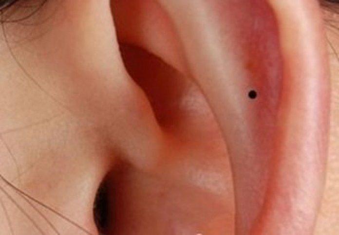 Nốt ruồi ở vành tai trong nữ giới