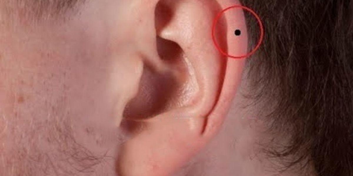 Nốt ruồi trên vành tai phải nam