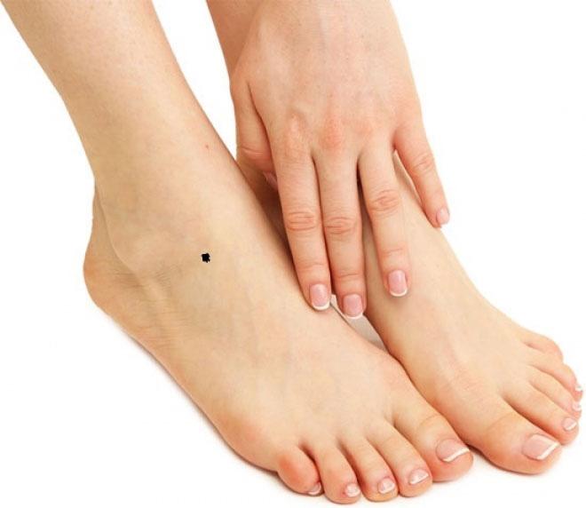 Có nên xóa nốt ruồi ở cổ chân không?