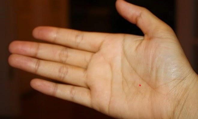 Nốt ruồi son ở lòng bàn tay có ý nghĩa gì?