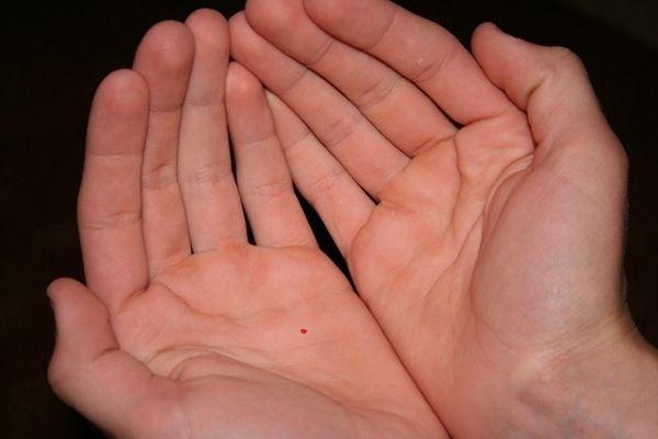 Xăm nốt ruồi son ở lòng bàn tay nên hay không? Nốt ruồi này mang ý nghĩa gì?