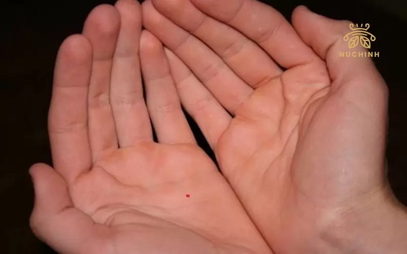 Xăm nốt ruồi son ở lòng bàn tay nên hay không? Nốt ruồi này mang ý nghĩa gì?